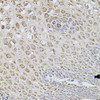 Cell Biology Antibodies 3 Anti-WISP2 Antibody CAB12541
