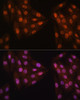 Cell Cycle Antibodies 1 Anti-MAD2L2 Antibody CAB12559