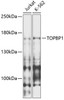 Epigenetics and Nuclear Signaling Antibodies 1 Anti-TOPBP1 Antibody CAB12574