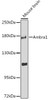Autophagy Antibodies Anti-Ambra1 Antibody CAB12578