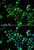 Cell Biology Antibodies 3 Anti-METTL13 Antibody CAB12582