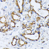 Cell Biology Antibodies 3 Anti-GOLM1 Antibody CAB12584