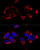 Cell Biology Antibodies 3 Anti-UQCR10 Antibody CAB12587