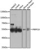 Epigenetics and Nuclear Signaling Antibodies 1 Anti-PRPF19 Antibody CAB12590