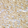 Cell Biology Antibodies 3 Anti-ARFGAP1 Antibody CAB12595