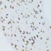 Cell Death Antibodies 1 Anti-MOAP1 Antibody CAB12599