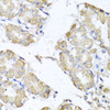 Immunology Antibodies 1 Anti-MICA Antibody CAB12622