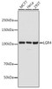 Cell Biology Antibodies 3 Anti-LGR4 Antibody CAB12657