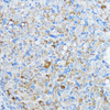 Cell Biology Antibodies 3 Anti-Aromatase Antibody CAB12684