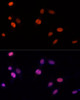 Cell Death Antibodies 1 Anti-PSME3 Antibody CAB12697