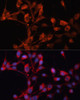 Signal Transduction Antibodies 1 Anti-SLC25A19 Antibody CAB12727
