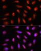 Cell Biology Antibodies 3 Anti-COPS8 Antibody CAB12745