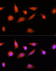 Cell Biology Antibodies 3 Anti-COPS8 Antibody CAB12745