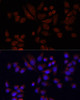 Signal Transduction Antibodies 1 Anti-NAT2 Antibody CAB12766