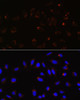 Cell Death Antibodies 1 Anti-Mitofusin 2 Antibody CAB12771