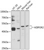 Metabolism Antibodies 1 Anti-ADIPOR2 Antibody CAB12777
