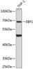 Epigenetics and Nuclear Signaling Antibodies 1 Anti-EBF1 Antibody CAB12782