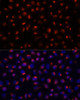 Cell Biology Antibodies 3 Anti-ACTN3 Antibody CAB12797