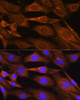 Cell Biology Antibodies 3 Anti-PHOSPHO2 Antibody CAB12816