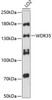 Cell Biology Antibodies 3 Anti-WDR35 Antibody CAB12824