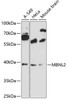Epigenetics and Nuclear Signaling Antibodies 1 Anti-MBNL2 Antibody CAB12838