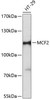 Cell Biology Antibodies 3 Anti-MCF2 Antibody CAB12839