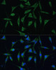 Cell Biology Antibodies 3 Anti-PALD1 Antibody CAB12893