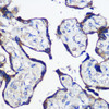 Cell Biology Antibodies 3 Anti-PARP8 Antibody CAB12894