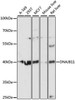 Cell Biology Antibodies 3 Anti-DNAJB11 Antibody CAB12915