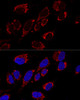 Cell Biology Antibodies 3 Anti-MRPS31 Antibody CAB12923