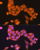 Cell Biology Antibodies 3 Anti-RAP1B Antibody CAB12925