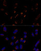 Signal Transduction Antibodies 1 Anti-MTCH2 Antibody CAB12934