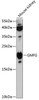 Signal Transduction Antibodies 1 Anti-GMFG Antibody CAB12955