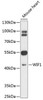 Metabolism Antibodies 1 Anti-WIF1 Antibody CAB12969