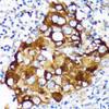 Metabolism Antibodies 1 Anti-WIF1 Antibody CAB12969