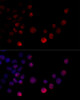 Cell Biology Antibodies 3 Anti-HNRNPH2 Antibody CAB12993