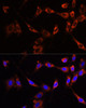 Cell Biology Antibodies 3 Anti-PTPN13 Antibody CAB13005