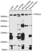 Cell Biology Antibodies 3 Anti-PTPN13 Antibody CAB13005