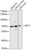 Cell Biology Antibodies 3 Anti-GPC1 Antibody CAB13019