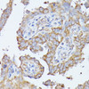 Metabolism Antibodies 1 Anti-HAL Antibody CAB13021