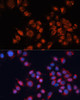 Signal Transduction Antibodies 1 Anti-IGF2R Antibody CAB13022