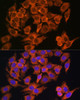 Cell Biology Antibodies 3 Anti-MYO6 Antibody CAB13033