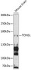 Epigenetics and Nuclear Signaling Antibodies 1 Anti-TONSL Antibody CAB13035