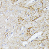 Cell Biology Antibodies 3 Anti-TBCA Antibody CAB13050