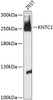 Cell Cycle Antibodies 1 Anti-KNTC1 Antibody CAB13064