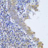 Metabolism Antibodies 1 Anti-GCN1L1 Antibody CAB13075