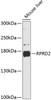 Cell Biology Antibodies 3 Anti-RPRD2 Antibody CAB13079