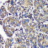 Signal Transduction Antibodies 1 Anti-SENP1 Antibody CAB13086