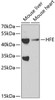 Signal Transduction Antibodies 1 Anti-HFE Antibody CAB1310