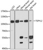 Cell Cycle Antibodies 1 Anti-TSPYL2 Antibody CAB13118